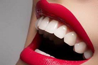 Viva-Dent Gabinety Stomatologiczne - Wybielanie zębów